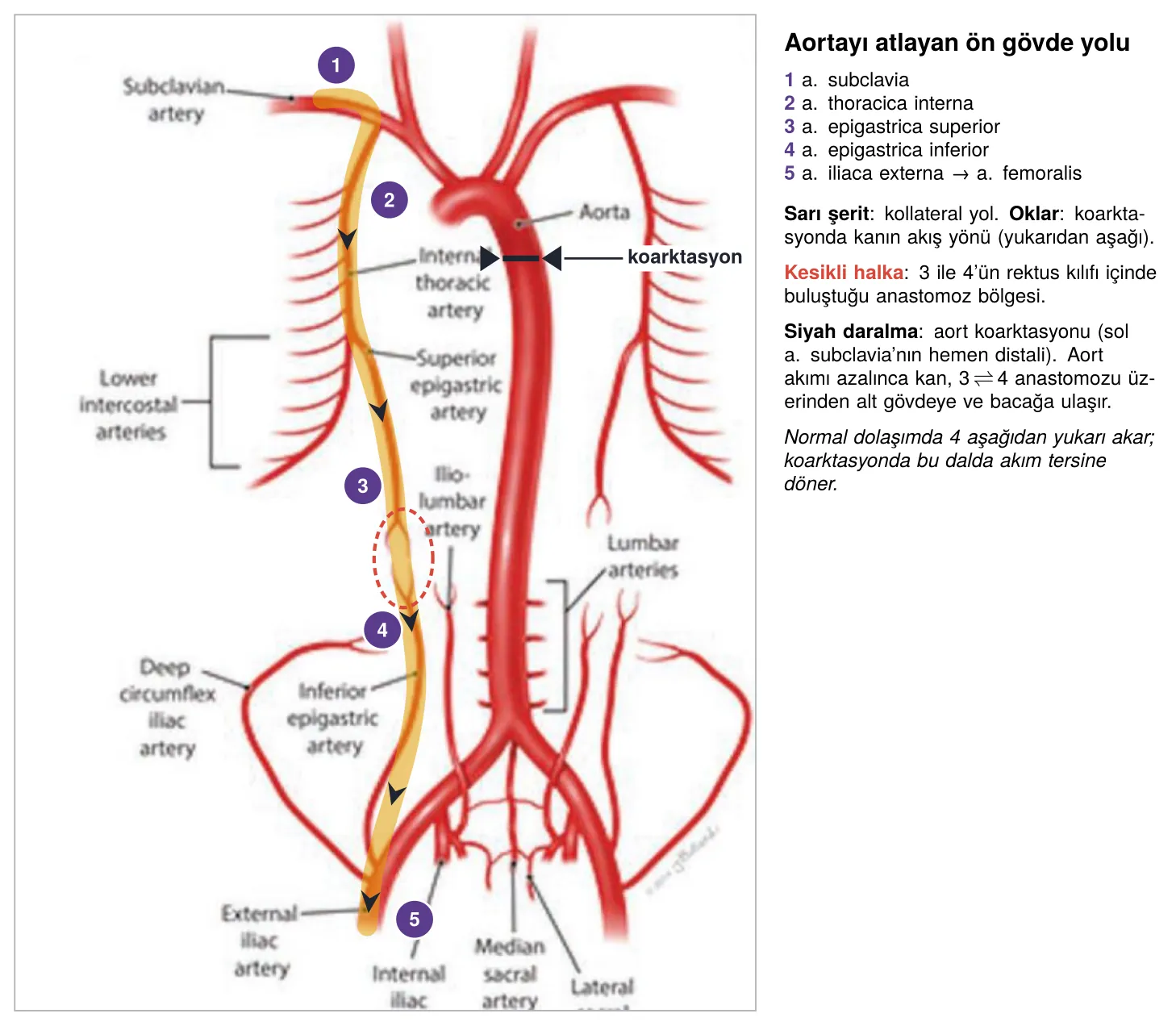 Aortayı atlayan subclavia–iliaca externa kollateral yolu (slayt 25 üzerinde)