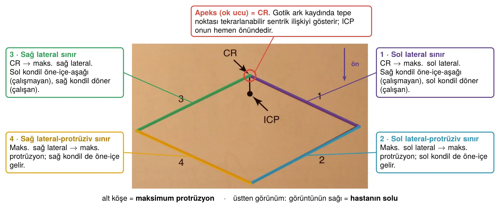 Horizontal düzlemde rombik sınır deseni