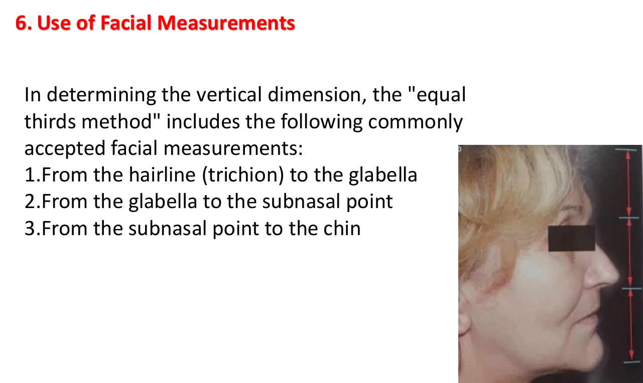 Eşit üçte birler: trichion–glabella, glabella–subnazal, subnazal–çene