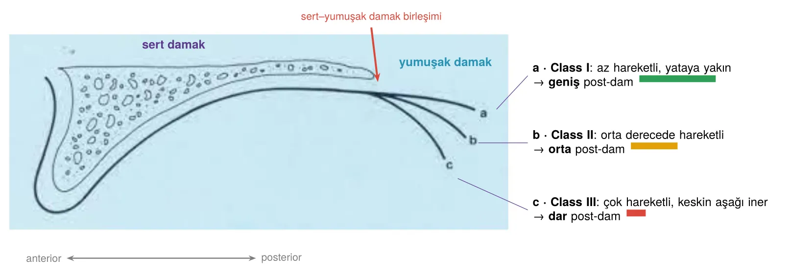 Yumuşak damak sınıfları ve post-dam genişliği