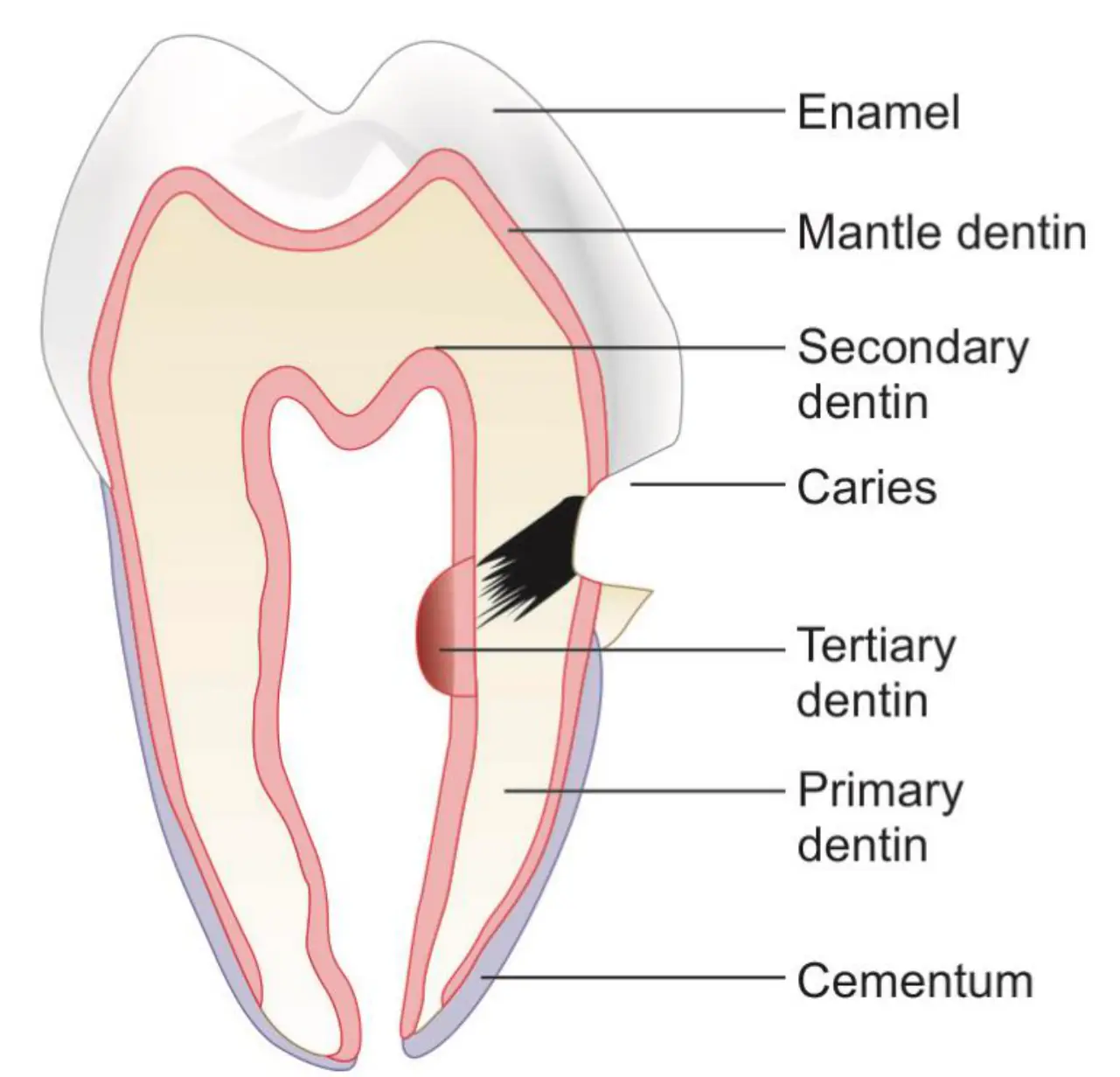 Molar kesitinde manto, primer, sekonder ve tersiyer dentinin konumları